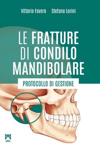 Le fratture di condilo mandibolare - Protocollo di gestione