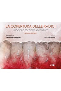 La copertura delle radici - Principi e tecniche avanzate